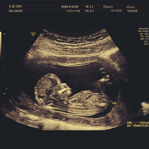 !欧美与动牲交zoZ0
